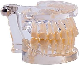 Qiaoxx dentes odontológicos modelo dentes odontológicos estudos de ensino de ensino modelo de cristal clear modelo de cristal
