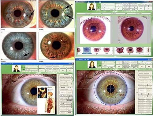 Analisador de Iris da Zweby Iris, Iridology Camera Computer Iris Detector 5 milhões de pixels de alta resolução 2560 * 1920 Interface