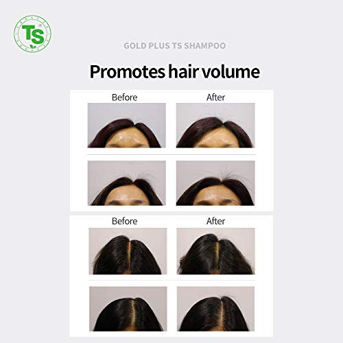 Gold Plus TS Shampoo para Crescimento do Cabelo e Espessura Ingredientes de Biotina de Gold de Luxúria | Para cabelos