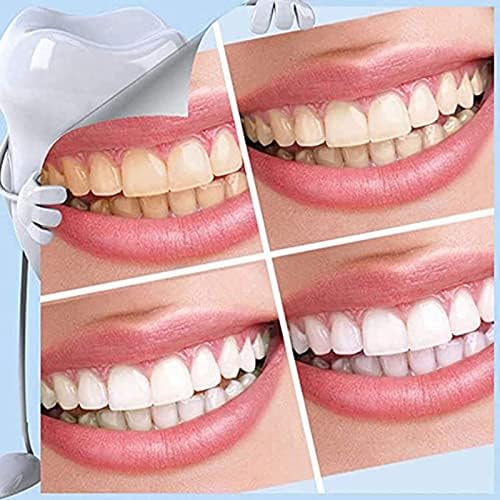 Kit de clareamento dos dentes, cuidados com higiene oral adequados para dentes amarelos, manchas de fumaça, dentes pretos removem efetivamente