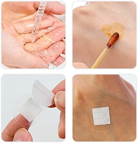 Spot Bandrages 200 Conde PU Bandagens adesivas à prova d'água transparentes curativos redondos para cuidados com as feridas First Aids Kids, Adults