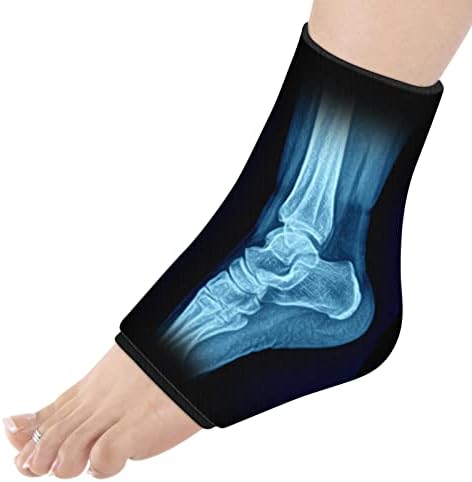 Tornozelo de gelo no tornozelo para lesões reutilizáveis ​​terapia de compressão de pacote de gelo de gelo para fasciite plantar, tendinite de Aquiles, torno de tornozelo, lesões esportivas, alívio da dor no calcanhar