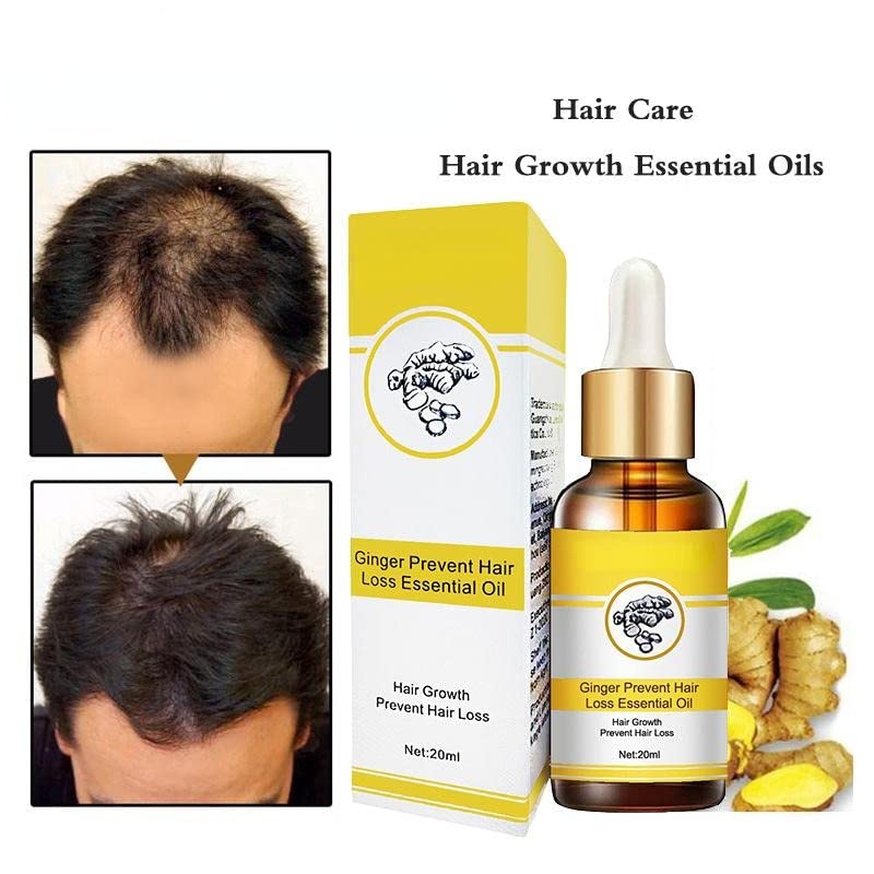 Weershun New Rosemary Oil for Beard Ginger Hair Growth Oil for Men Essence Hair Nutrient Condicionador de óleo essencial para mulheres
