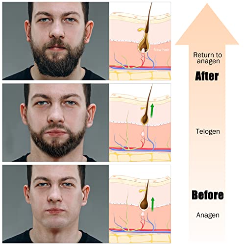 Rolo de barba para crescimento irregular da barba, barba derma roller microneedle roller barba kit de crescimento de barba