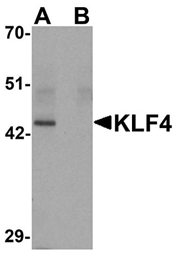 Anticorpo KLF4 [4E5C3]