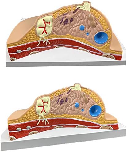 Modelo de mama feminina KH66ZKY - Período de lactação do período de lactação Modelo anatômico - seção transversal patológica Modelo 3 PCs