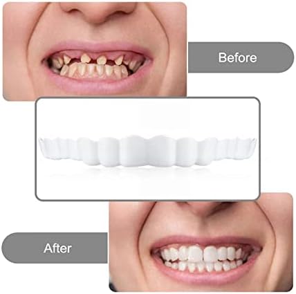 3 pares instantâneos facetas de traneadores Brace de dentes falsos Sorriam os dentes maiores dentes falsos de dentes cosméticos