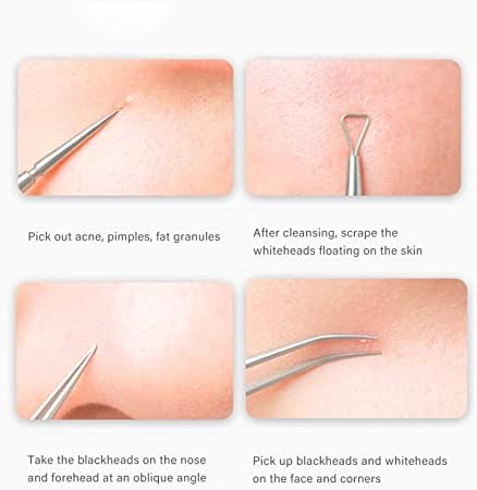 Ferramenta de remoção do cravo, kit de ferramentas de extrator de Pimple Popper, usado para remover cravos, acne, comedone, falha