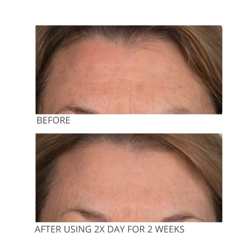 Pedis de éster de vitamina C graves de pele s grave-tratamento facial antienvelhecimento para pele mais suave e suave-almofadas
