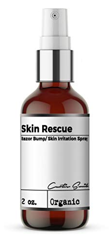 XOTICS de Curtis Smith - Skin Rescue Spray de irritação da pele de resgate - 2 oz - Formulada profissionalmente para combater a queima de barbear e a baixa irritação da pele - aprimorada com óleo da árvore do chá, aloe vera e lavanda