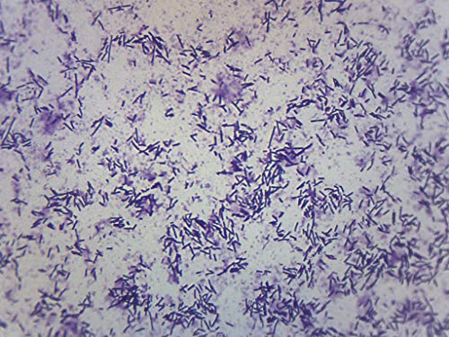 10pk Escherichia coli mancha, mancha de grama, lâminas de microscópio preparadas - 75 x 25mm - pacote de sala de aula, 10 slides