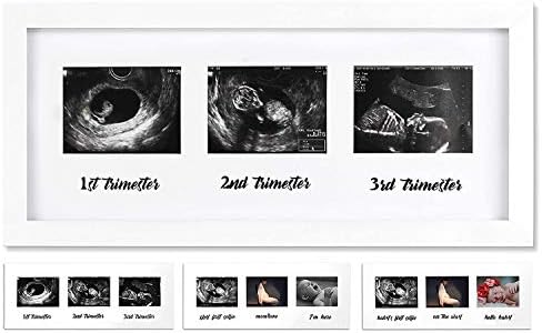 IHEIPYE Triple Sonogram Grate - moldura de imagem por ultrassom de bebê para esperar pais, moldura do chá de bebê, festa de revelação
