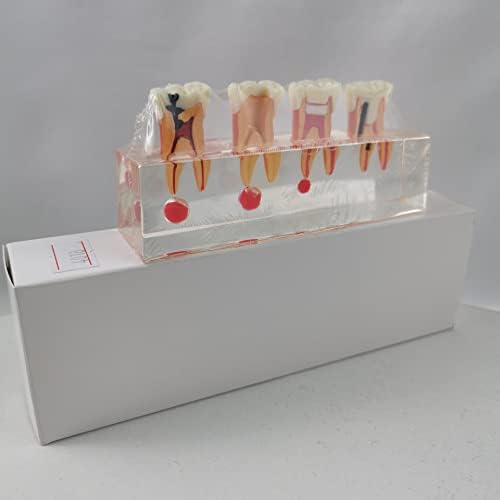 Modelo de dente endodôntico KH66ZKY Modelo dental Modelo de dentes humanos Modelo de escovação de dente para ensinar o estudo