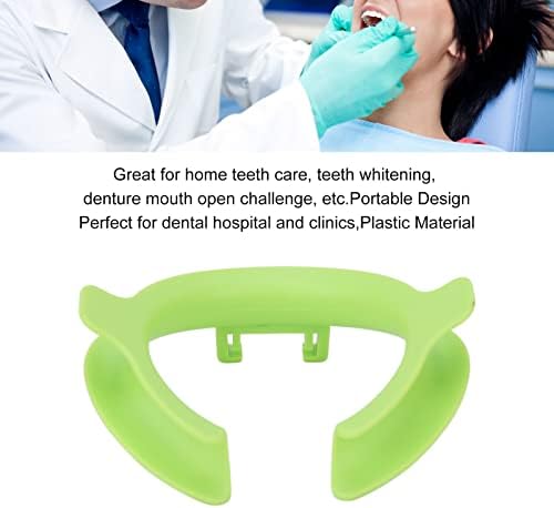 Abridor de boca, Retator de bochecha dental profissional de plástico seguro para o clareamento dos dentes para a clínica
